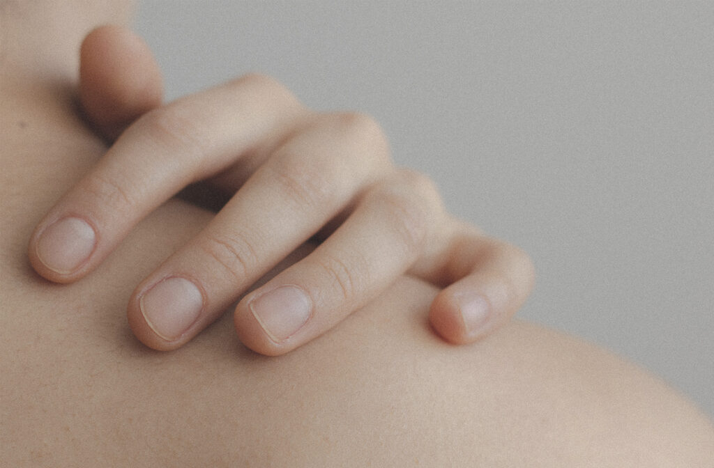 Dermatitis por contacto